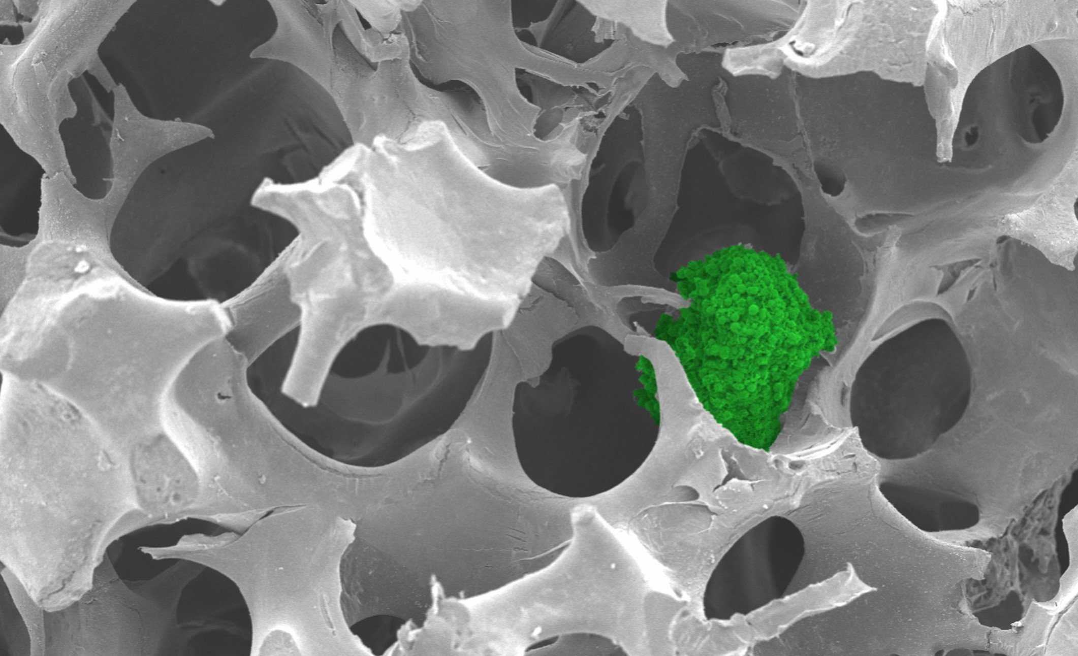 Cancer spheroid growing in the ABS sponge